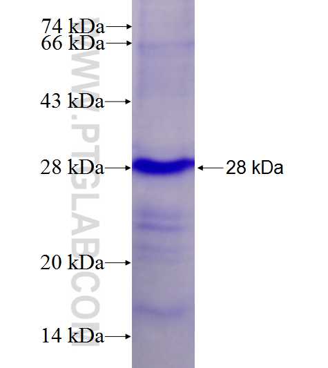 CXXC1 fusion protein Ag27567 SDS-PAGE