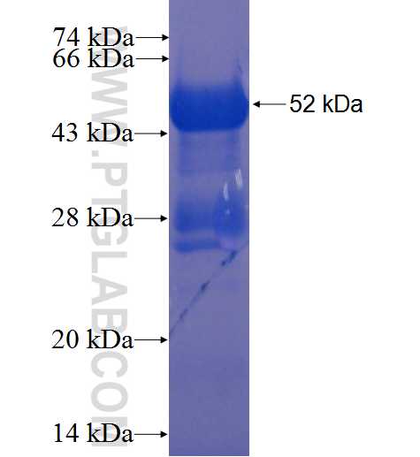 CXXC1 fusion protein Ag1766 SDS-PAGE