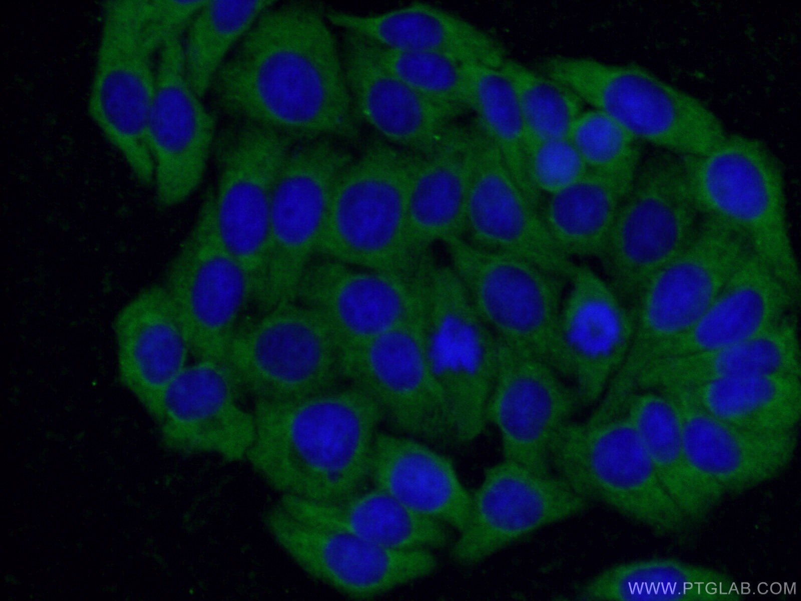 IF Staining of HepG2 using 16513-1-AP