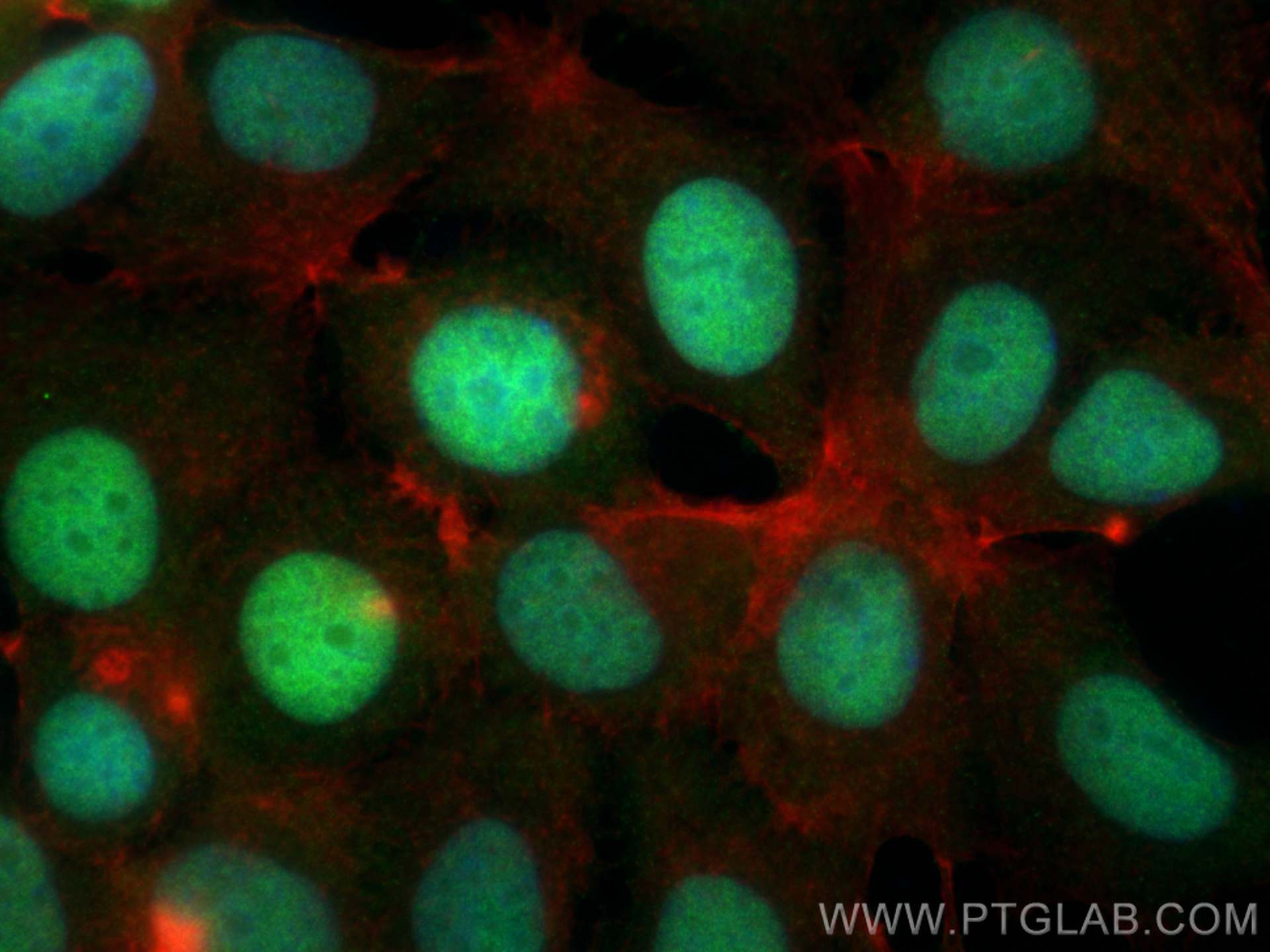 Immunofluorescence (IF) / fluorescent staining of MCF-7 cells using CXXC5 Polyclonal antibody (16513-1-AP)