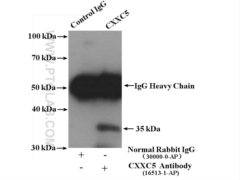 Immunoprecipitation (IP) experiment of SH-SY5Y cells using CXXC5 Polyclonal antibody (16513-1-AP)