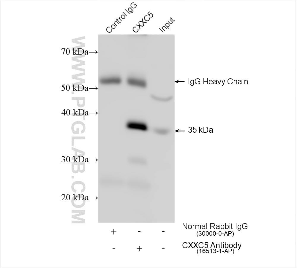 Immunoprecipitation (IP) experiment of SH-SY5Y cells using CXXC5 Polyclonal antibody (16513-1-AP)