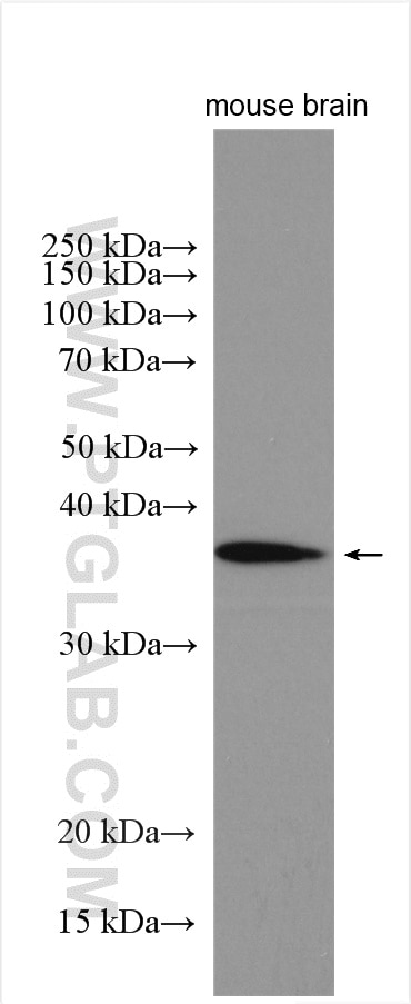 Western Blot (WB) analysis of mouse brain tissue using CXXC5 Polyclonal antibody (16513-1-AP)