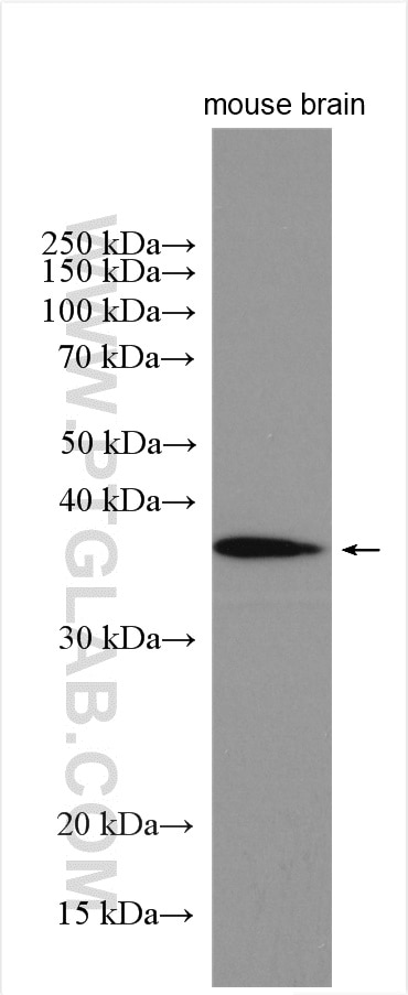 WB analysis of mouse brain using 16513-1-AP