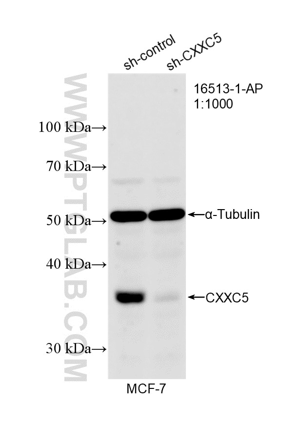 WB analysis of MCF-7 using 16513-1-AP Western Blot (WB) analysis of MCF-7 cells using CXXC5 Polyclonal antibody (16513-1-AP)