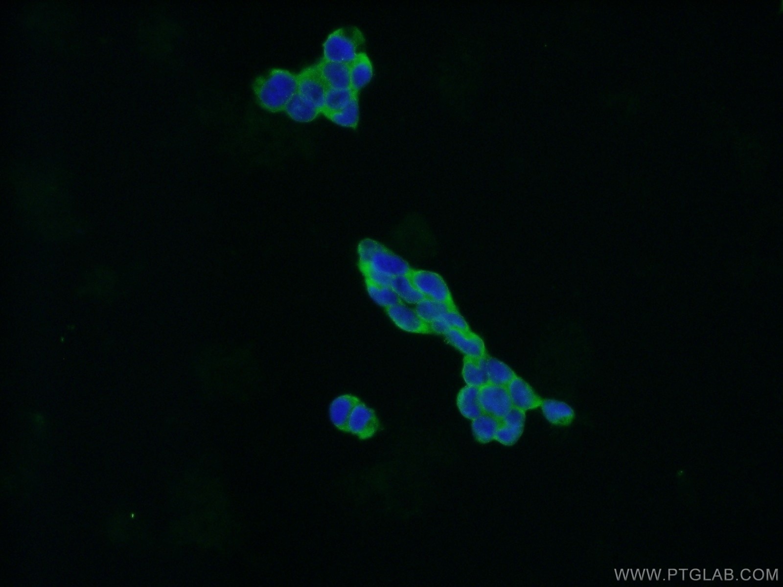 Immunofluorescence (IF) / fluorescent staining of HEK-293 cells using CXorf15 Polyclonal antibody (22357-1-AP)