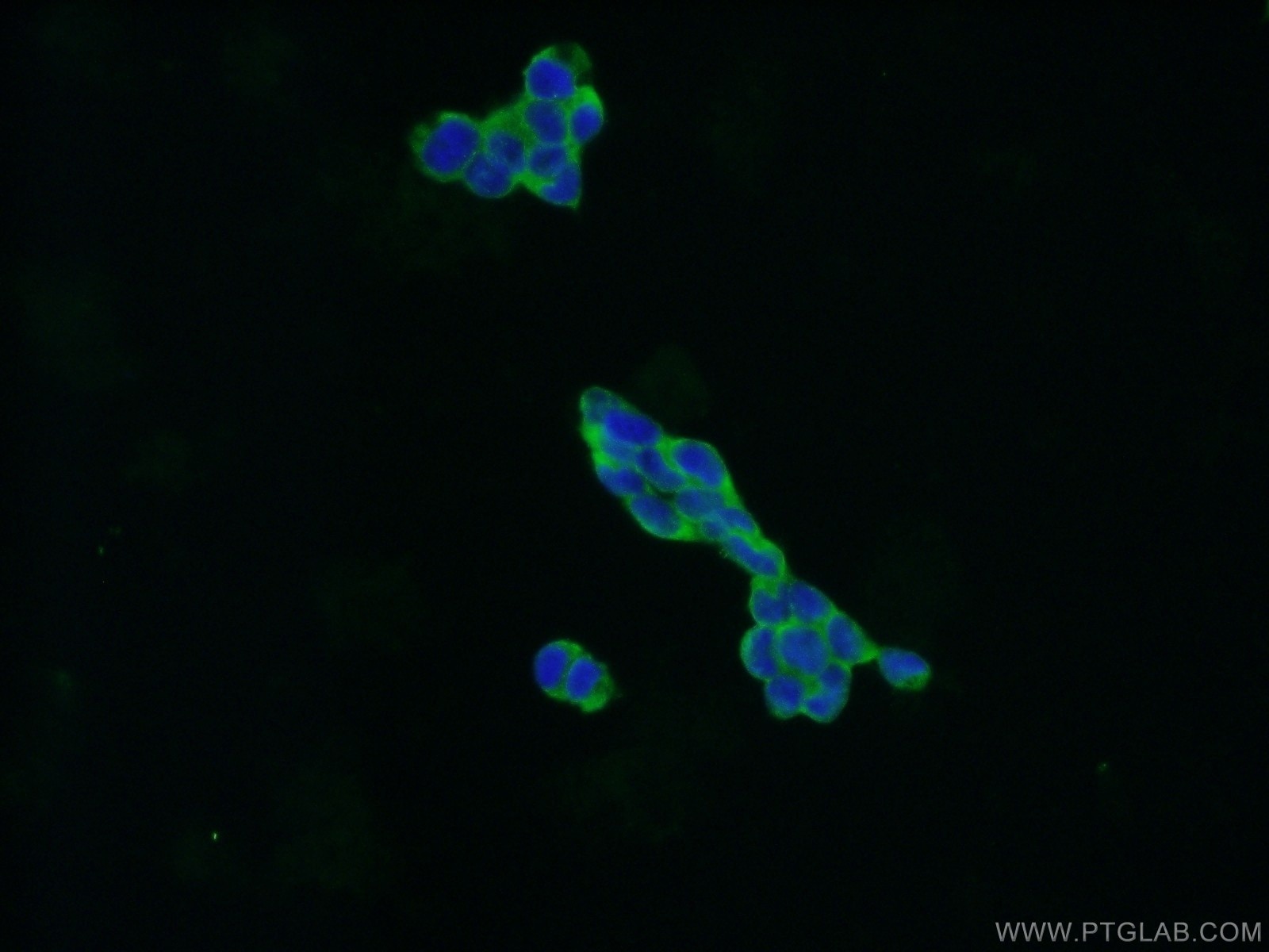 IF Staining of HEK-293 using 22357-1-AP