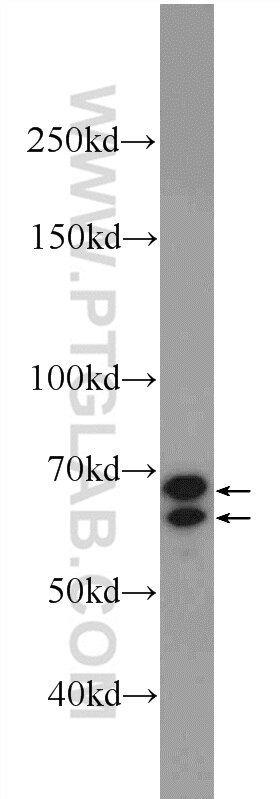 Western Blot (WB) analysis of MCF-7 cells using CXorf15 Polyclonal antibody (22357-1-AP)