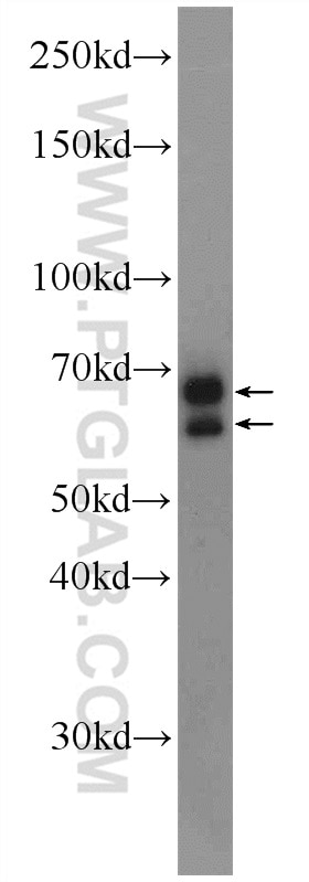 Western Blot (WB) analysis of Jurkat cells using CXorf15 Polyclonal antibody (22357-1-AP)