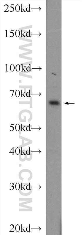 Western Blot (WB) analysis of mouse kidney tissue using CXorf15 Polyclonal antibody (22357-1-AP)