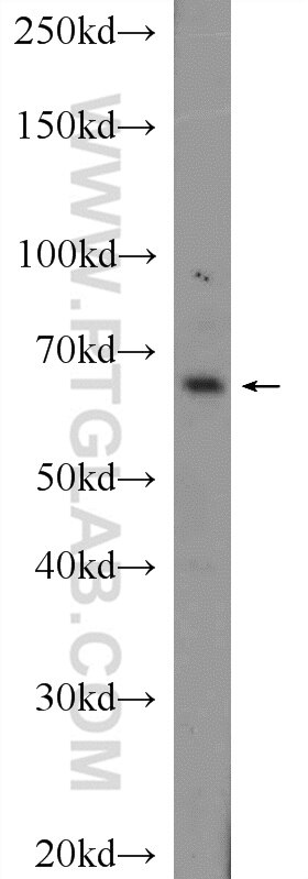 Western Blot (WB) analysis of mouse kidney tissue using CXorf15 Polyclonal antibody (22357-1-AP)