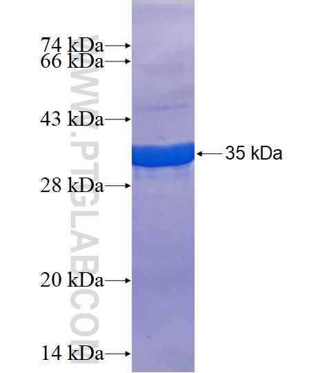 CXorf15 fusion protein Ag17936 SDS-PAGE