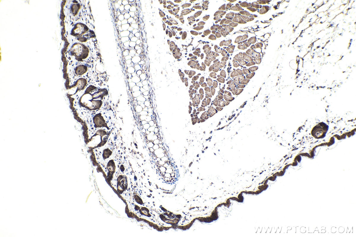 Immunohistochemistry (IHC) staining of mouse skin tissue using CXorf21 Polyclonal antibody (30244-1-AP)