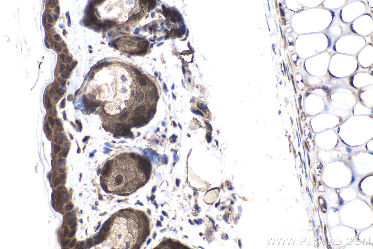 Immunohistochemistry (IHC) staining of mouse skin tissue using CXorf21 Polyclonal antibody (30244-1-AP)