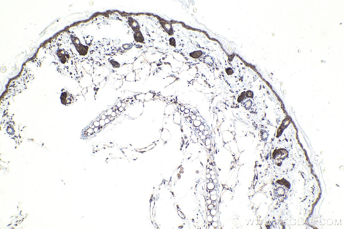 Immunohistochemistry (IHC) staining of rat skin tissue using CXorf21 Polyclonal antibody (30244-1-AP)