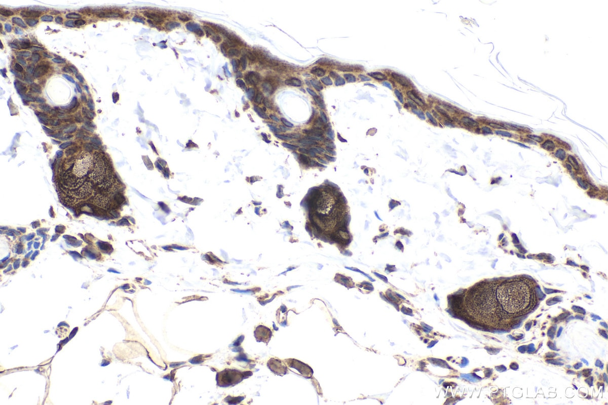 Immunohistochemistry (IHC) staining of rat skin tissue using CXorf21 Polyclonal antibody (30244-1-AP)