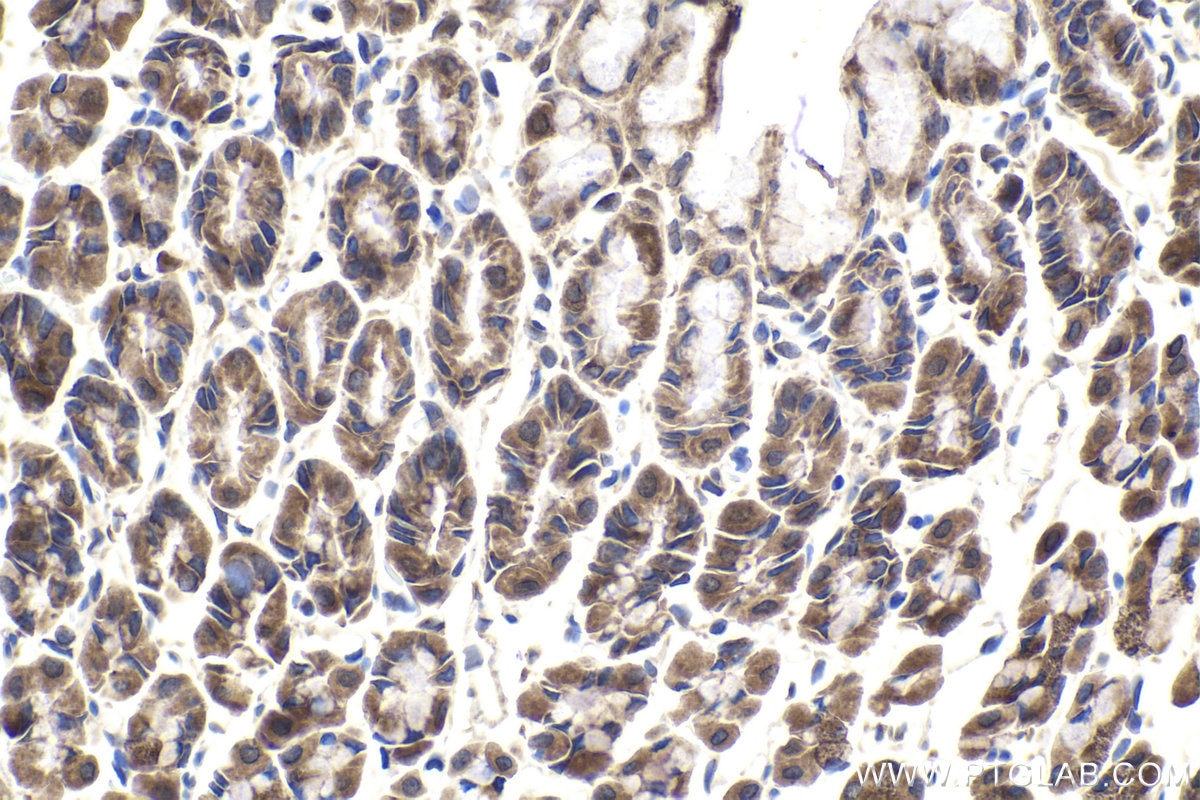 Immunohistochemistry (IHC) staining of rat stomach tissue using CXorf21 Polyclonal antibody (30244-1-AP)