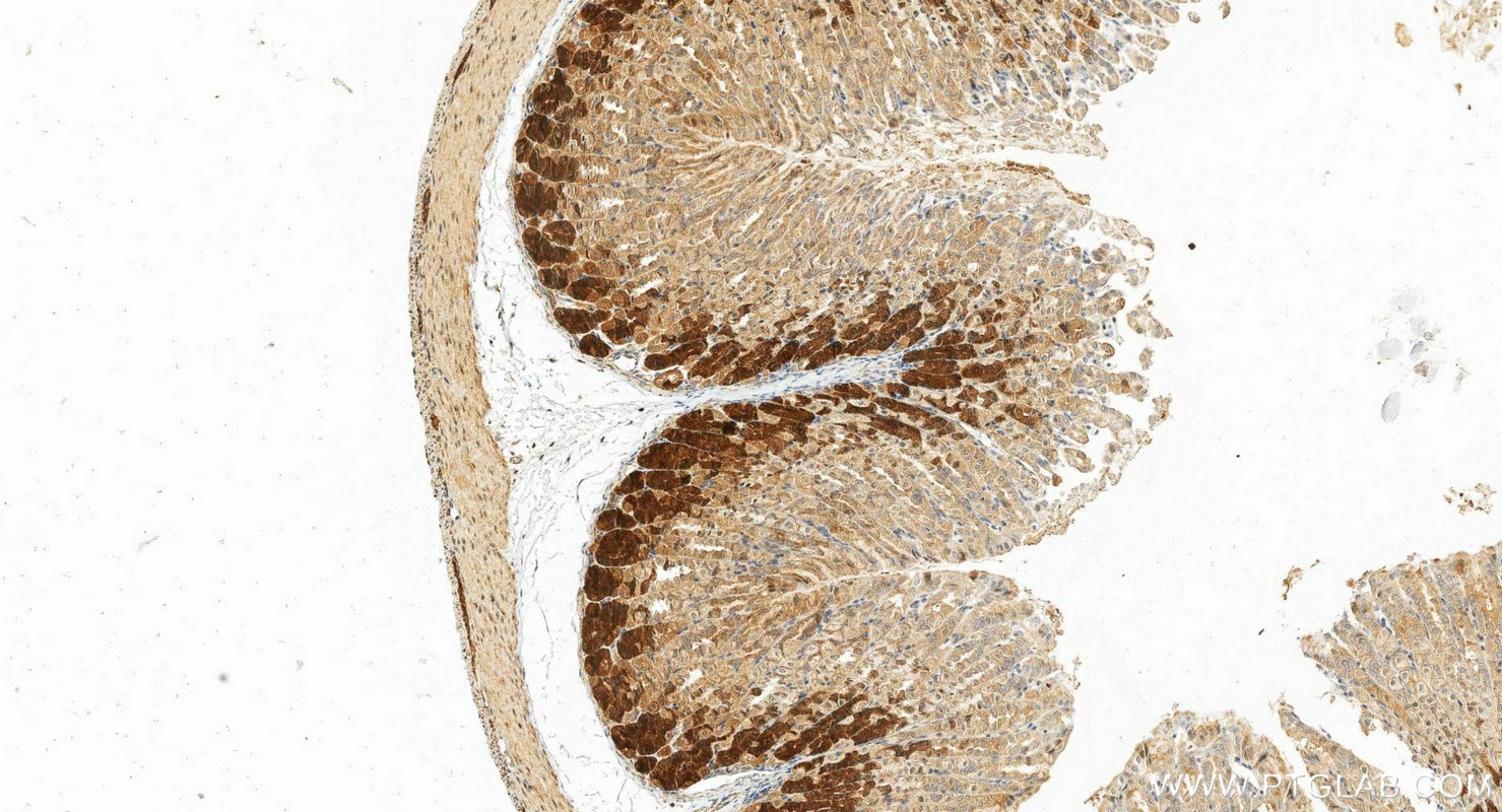IHC staining of mouse stomach using 30244-1-AP Immunohistochemistry (IHC) staining of mouse stomach tissue using CXorf21 Polyclonal antibody (30244-1-AP)
