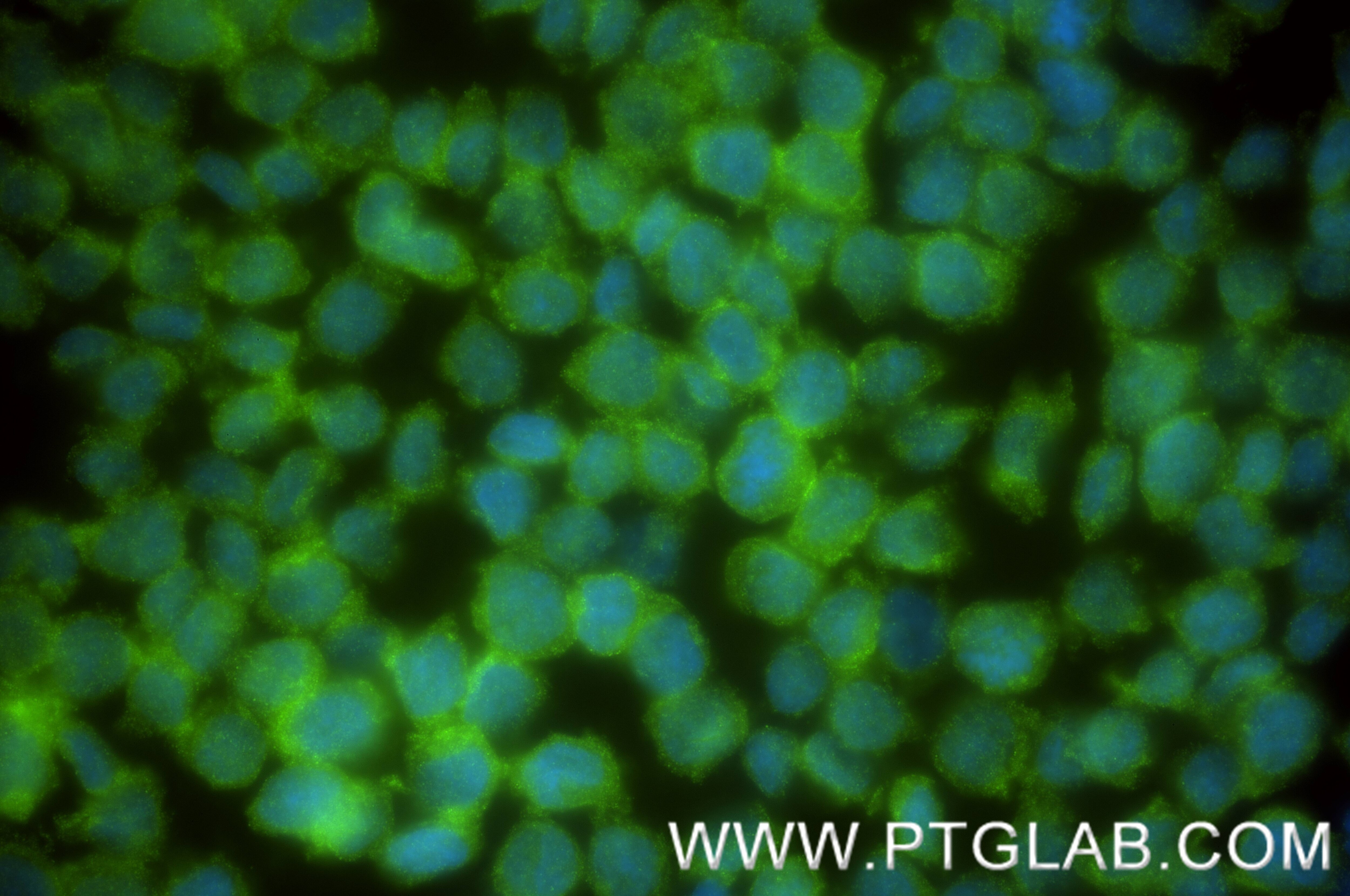 IF Staining of THP-1 using 88004-1-RR Immunofluorescence (IF) / fluorescent staining of THP-1 cells using CXorf21 Recombinant monoclonal antibody (88004-1-RR)
