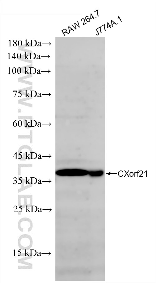 WB analysis using 88004-1-RR Western Blot (WB) analysis of various lysates using CXorf21 Recombinant monoclonal antibody (88004-1-RR)