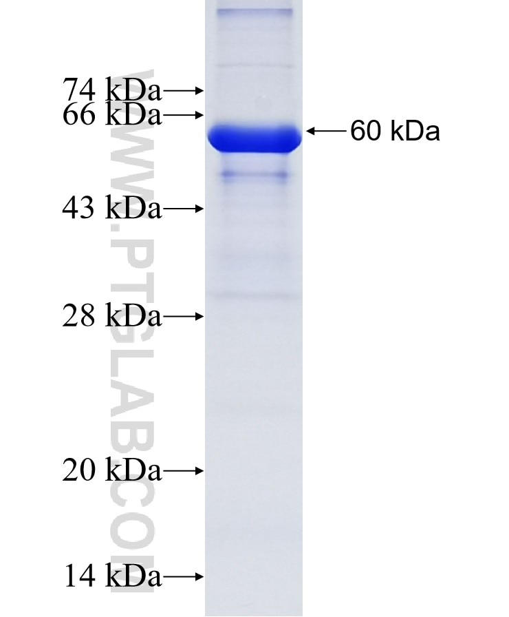 CXorf21 fusion protein Ag32773 SDS-PAGE