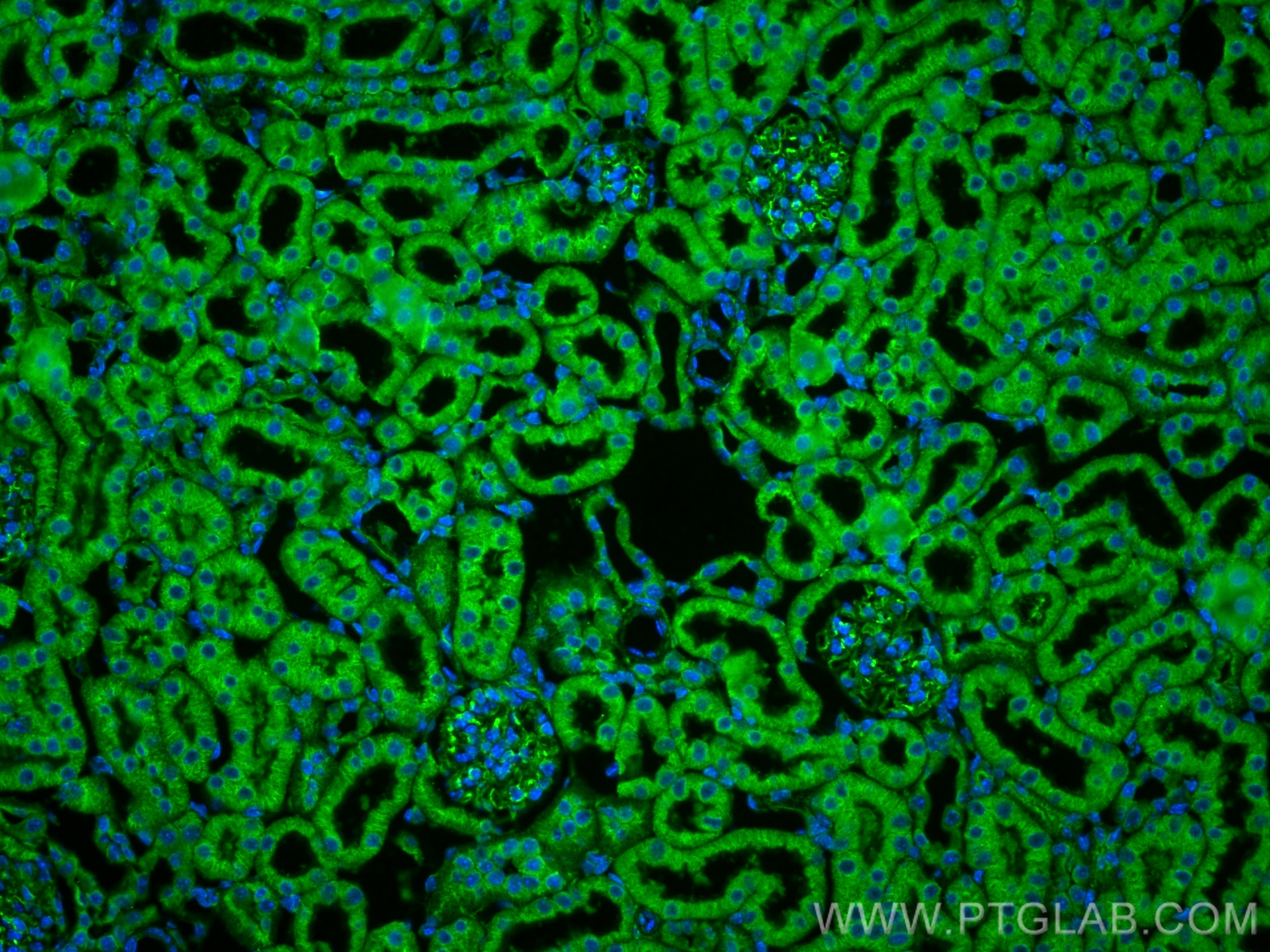 Immunofluorescence (IF) / fluorescent staining of mouse kidney tissue using CFAP47 Polyclonal antibody (20837-1-AP)