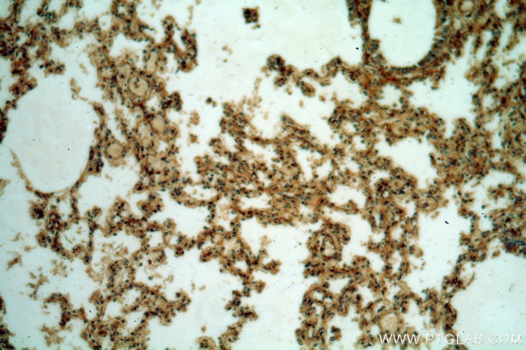 IHC staining of human lung using 20837-1-AP