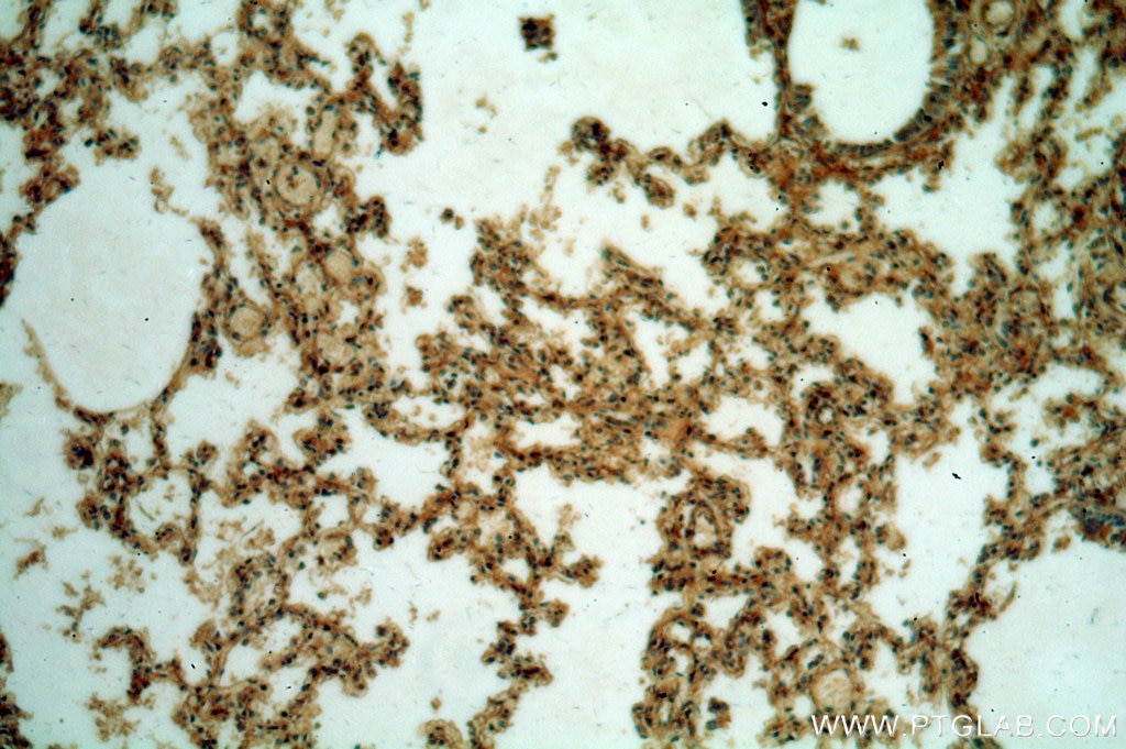 Immunohistochemistry (IHC) staining of human lung tissue using CXorf22 Polyclonal antibody (20837-1-AP)