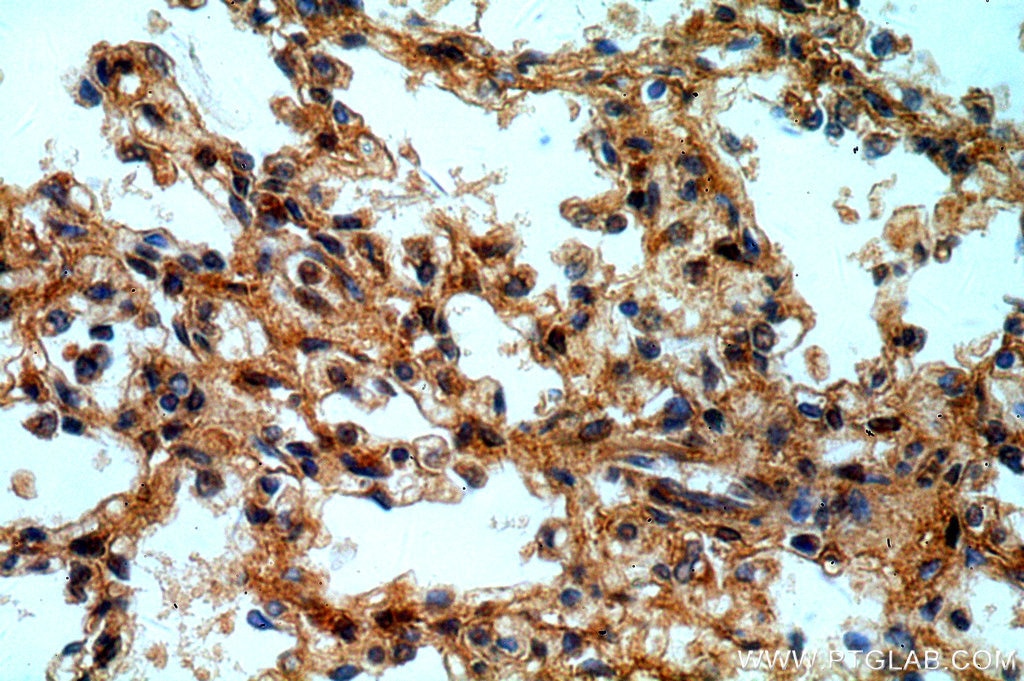Immunohistochemistry (IHC) staining of human lung tissue using CXorf22 Polyclonal antibody (20837-1-AP)