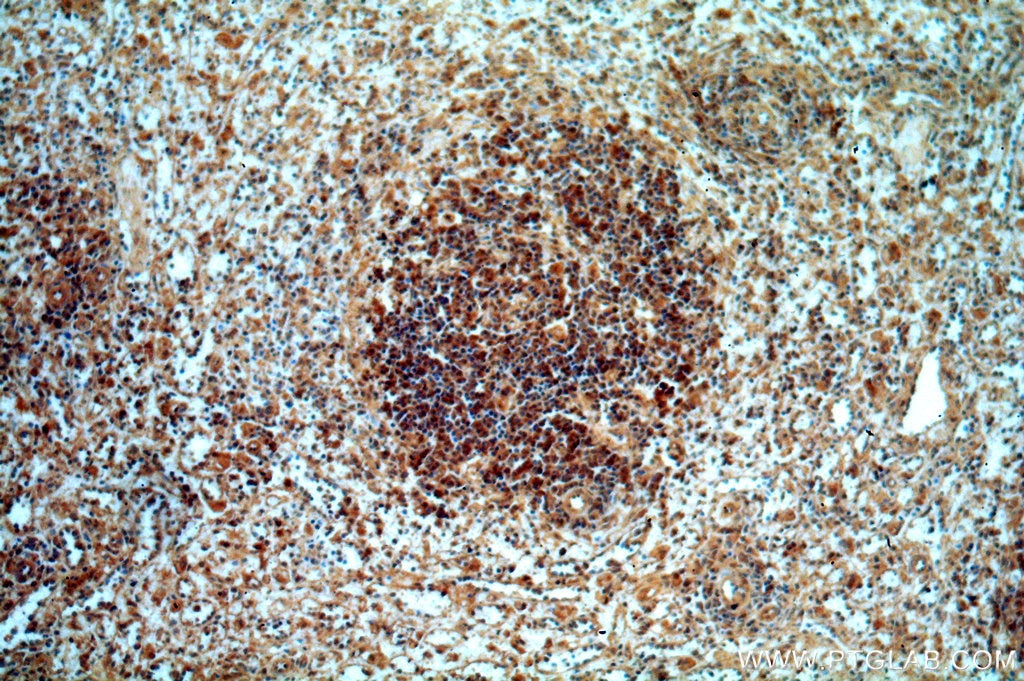 Immunohistochemistry (IHC) staining of human spleen tissue using CXorf22 Polyclonal antibody (20837-1-AP)