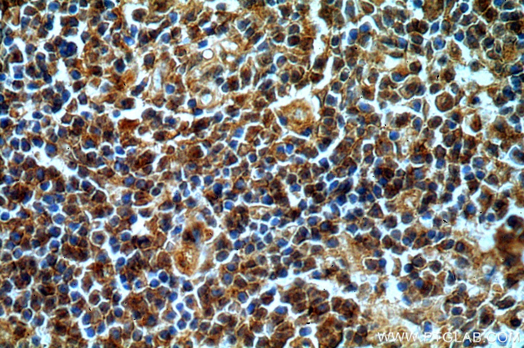 Immunohistochemistry (IHC) staining of human spleen tissue using CXorf22 Polyclonal antibody (20837-1-AP)