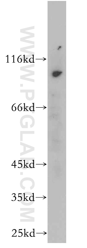 Western Blot (WB) analysis of mouse lung tissue using CXorf22 Polyclonal antibody (20837-1-AP)