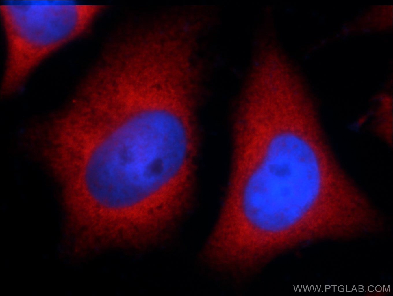 Immunofluorescence (IF) / fluorescent staining of HeLa cells using CXorf26 Polyclonal antibody (20137-1-AP)