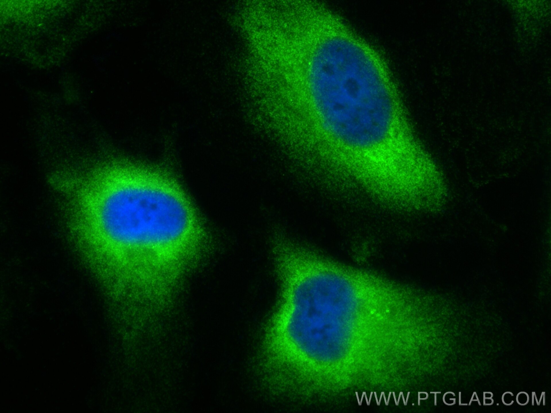 Immunofluorescence (IF) / fluorescent staining of HeLa cells using CXorf26 Polyclonal antibody (20137-1-AP)