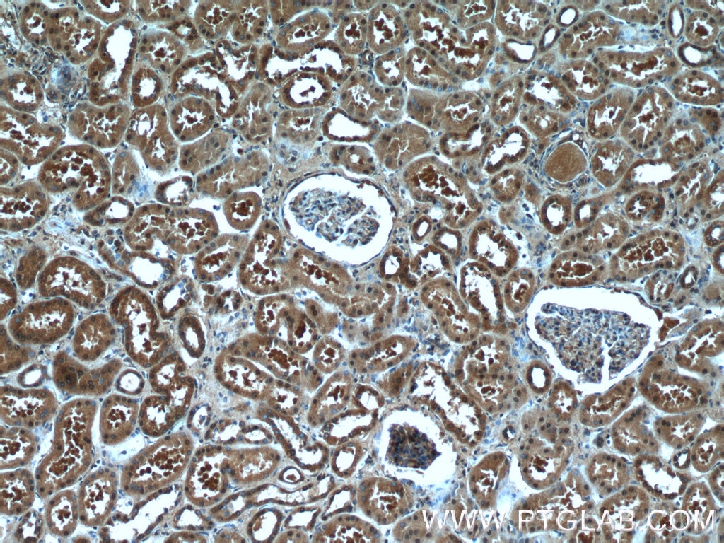 IHC staining of human kidney using 20137-1-AP