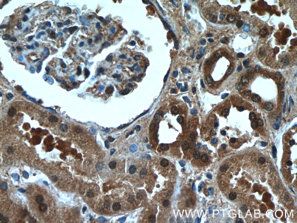Immunohistochemistry (IHC) staining of human kidney tissue using CXorf26 Polyclonal antibody (20137-1-AP)