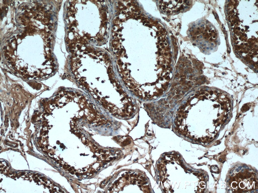 Immunohistochemistry (IHC) staining of human testis tissue using CXorf26 Polyclonal antibody (20137-1-AP)