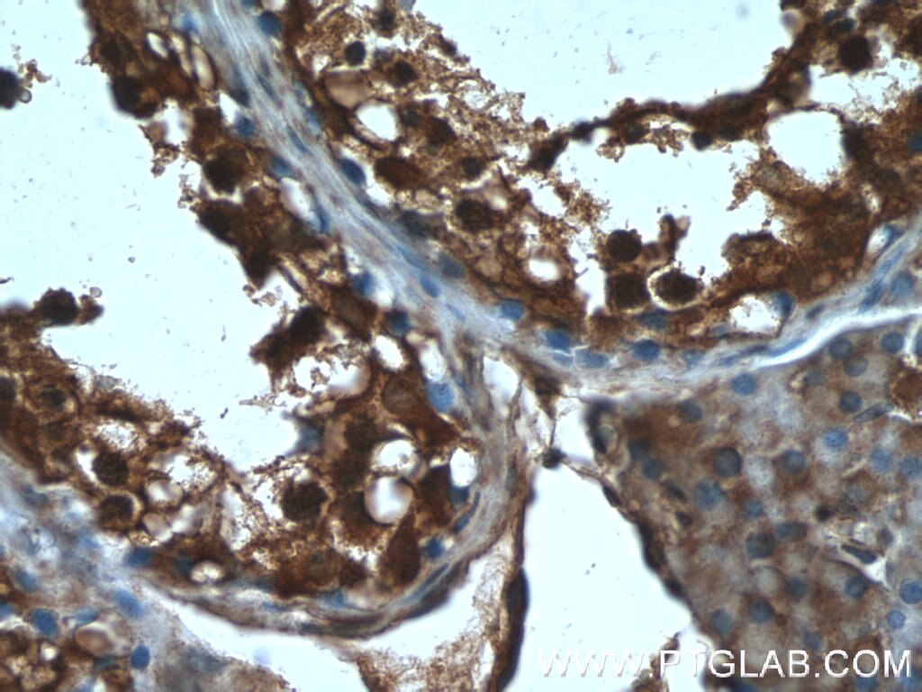 IHC staining of human testis using 20137-1-AP