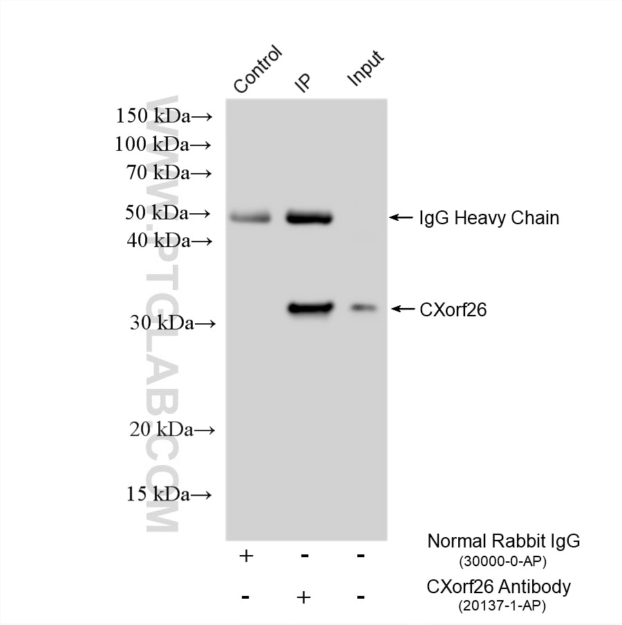Immunoprecipitation (IP) experiment of A549 cells using CXorf26 Polyclonal antibody (20137-1-AP)
