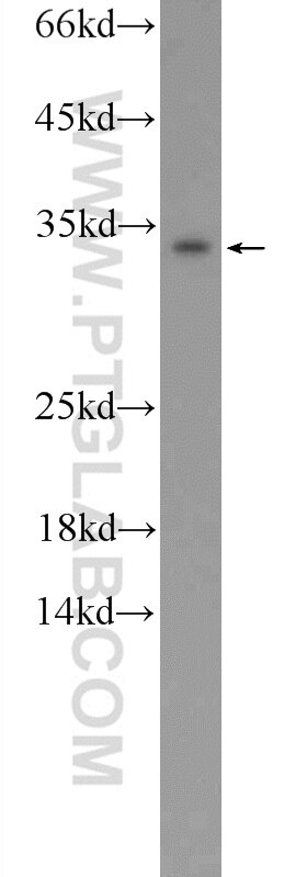 Western Blot (WB) analysis of HeLa cells using CXorf26 Polyclonal antibody (20137-1-AP)