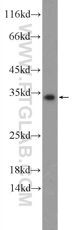 Western Blot (WB) analysis of A549 cells using CXorf26 Polyclonal antibody (20137-1-AP)
