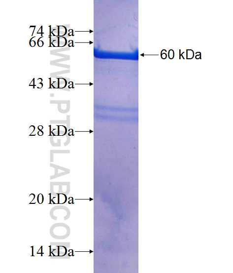 CXorf26 fusion protein Ag14089 SDS-PAGE