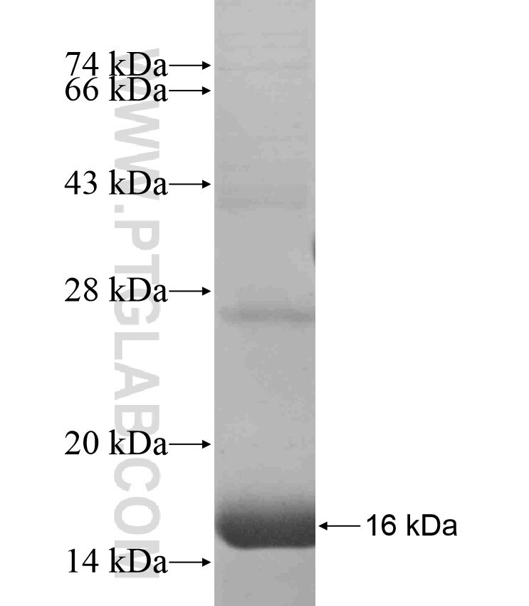 CXorf27 fusion protein Ag17974 SDS-PAGE