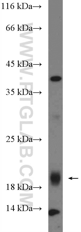 Western Blot (WB) analysis of HL-60 cells using CXorf38 Polyclonal antibody (26921-1-AP)