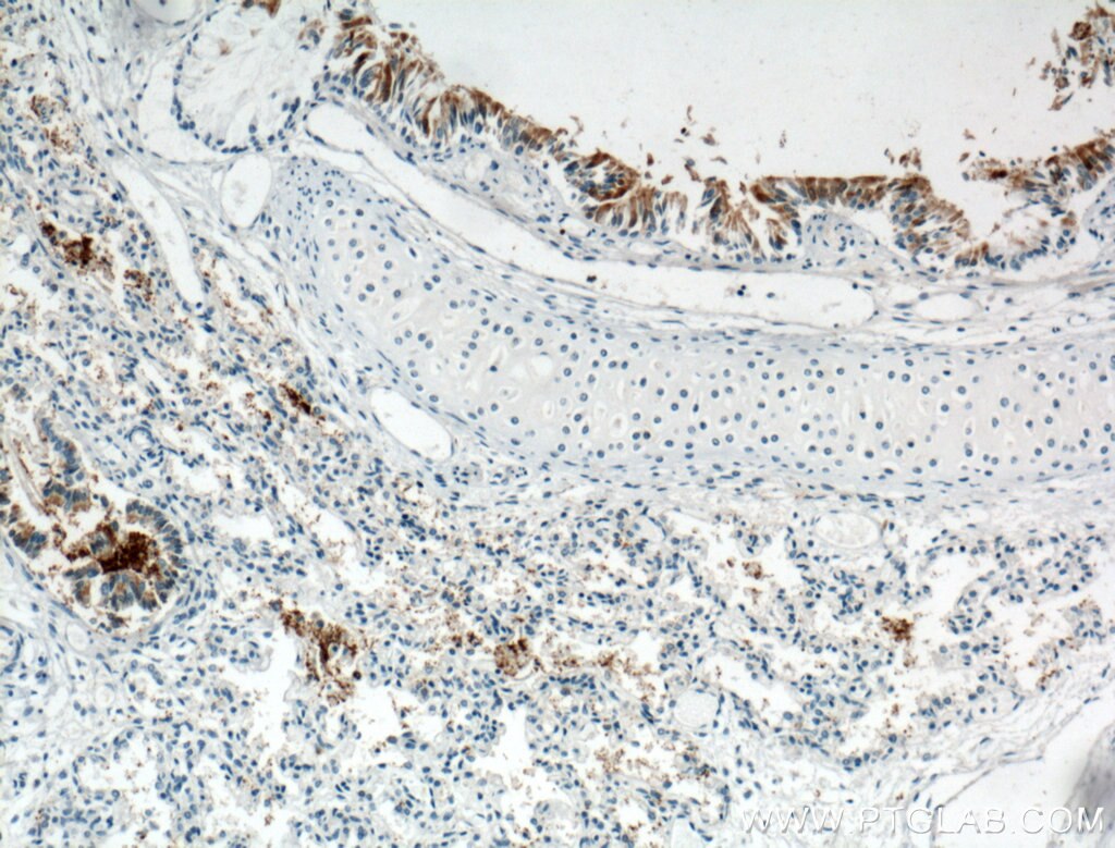 Immunohistochemistry (IHC) staining of human lung tissue using PIH1D3 Polyclonal antibody (25309-1-AP)