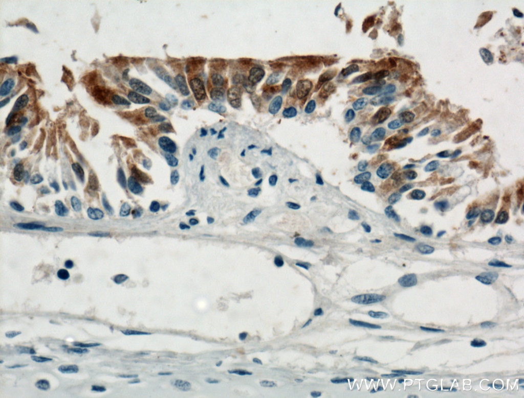Immunohistochemistry (IHC) staining of human lung tissue using PIH1D3 Polyclonal antibody (25309-1-AP)