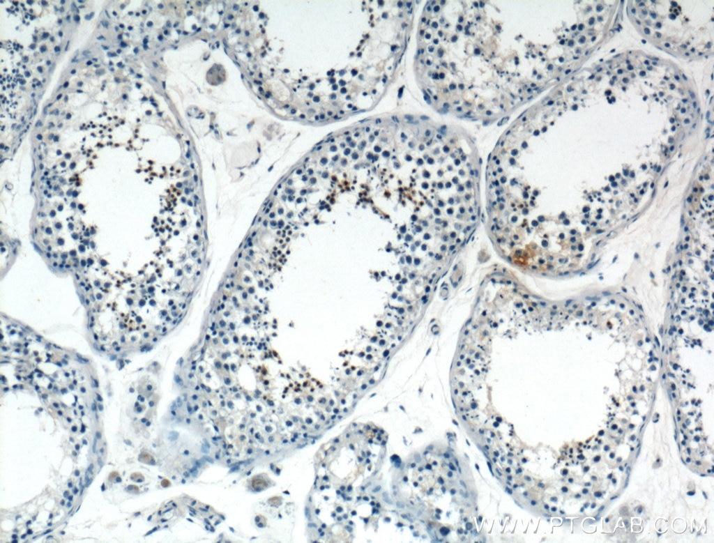 Immunohistochemistry (IHC) staining of human testis tissue using PIH1D3 Polyclonal antibody (25309-1-AP)