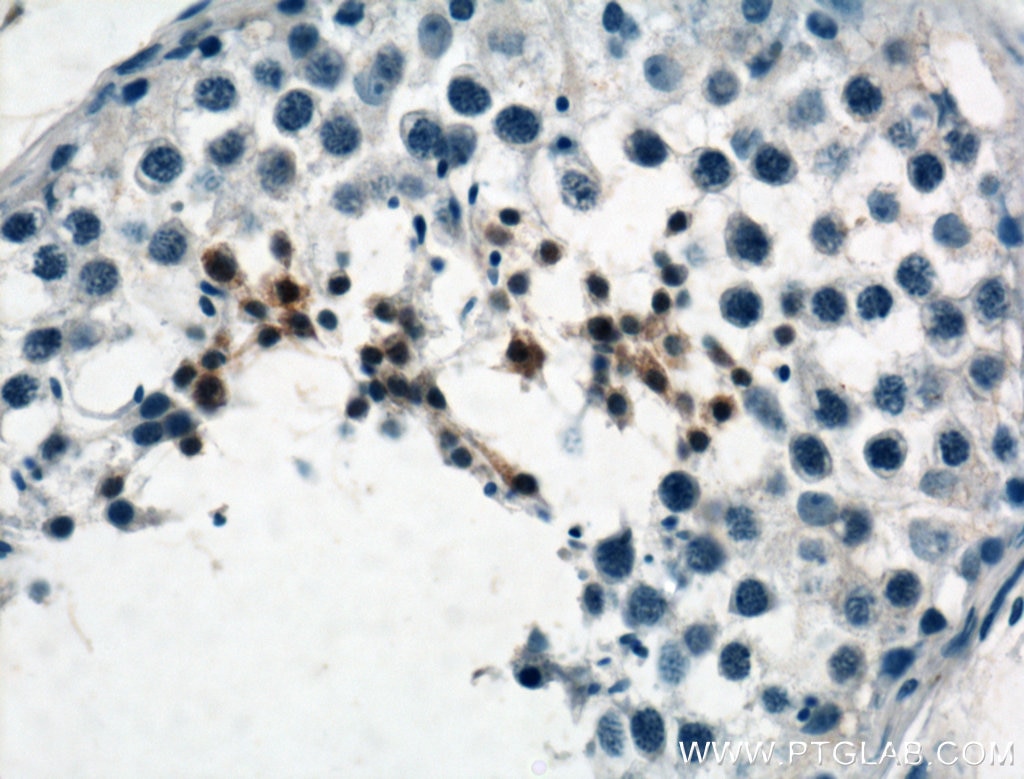 Immunohistochemistry (IHC) staining of human testis tissue using PIH1D3 Polyclonal antibody (25309-1-AP)
