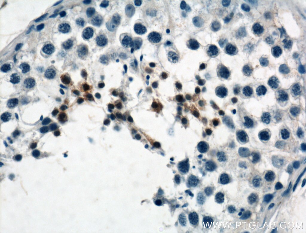 IHC staining of human testis using 25309-1-AP