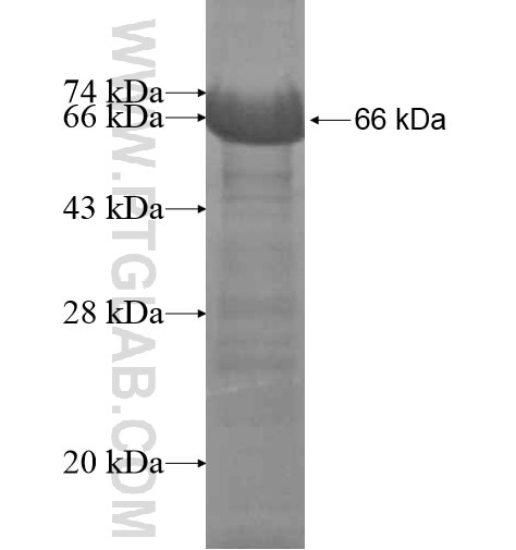 CXorf41 fusion protein Ag15039 SDS-PAGE